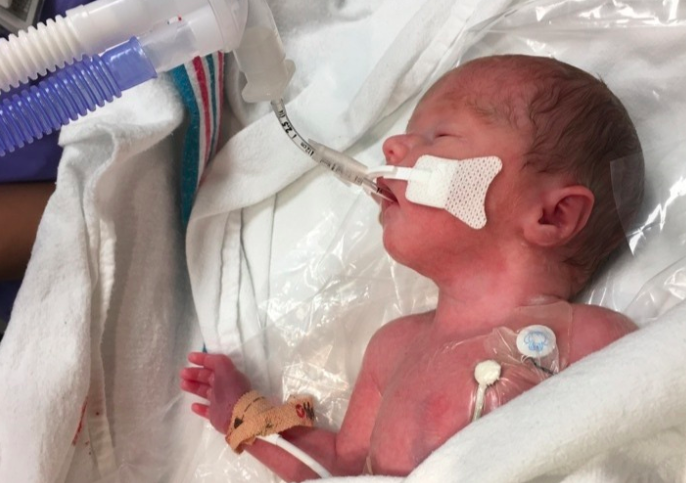 Campbell River mother in medical coma, baby in NICU