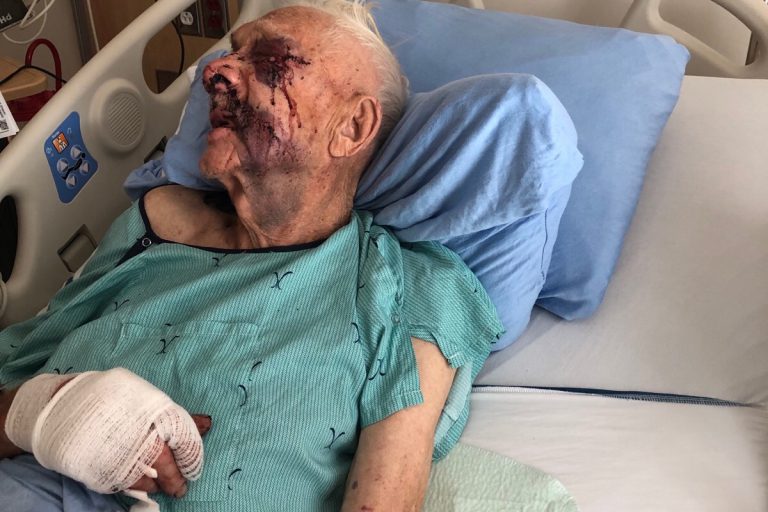 GoFundMe page grows for 89-year-old machete attack victim